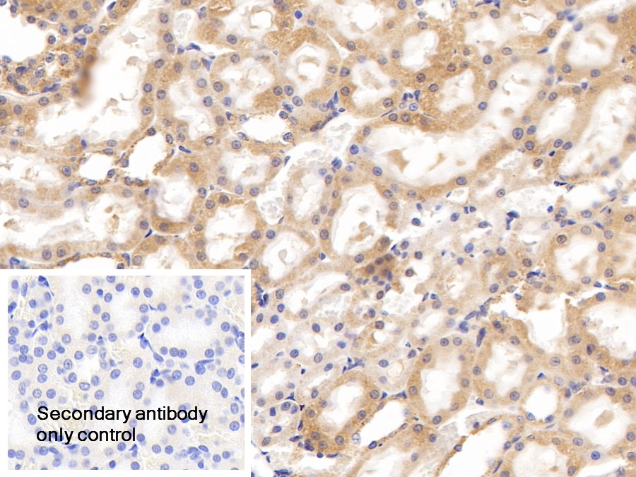 Polyclonal Antibody to Vascular Cell Adhesion Molecule 1 (VCAM1)