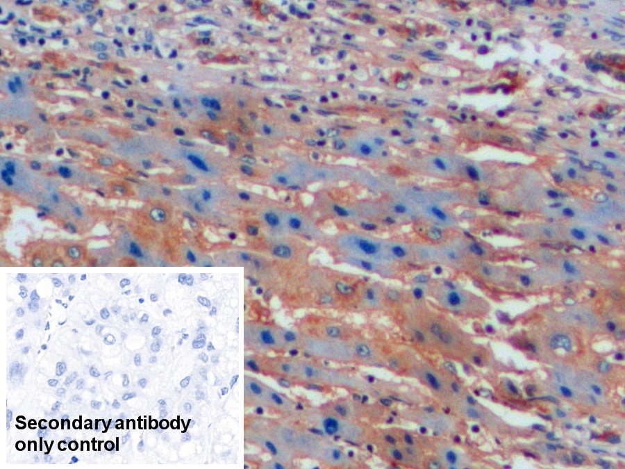 Polyclonal Antibody to Intercellular Adhesion Molecule 1 (ICAM1)