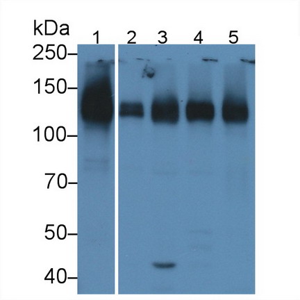 Polyclonal Antibody to Intercellular Adhesion Molecule 1 (ICAM1)