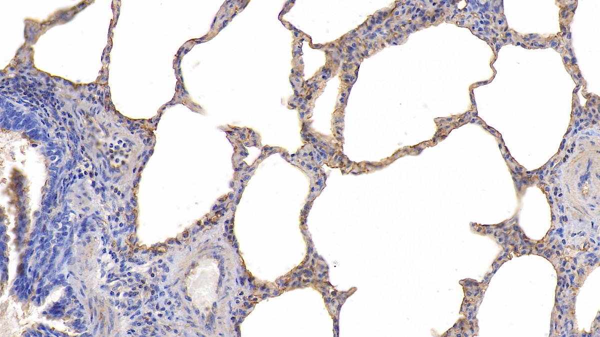 Polyclonal Antibody to Intercellular Adhesion Molecule 1 (ICAM1)