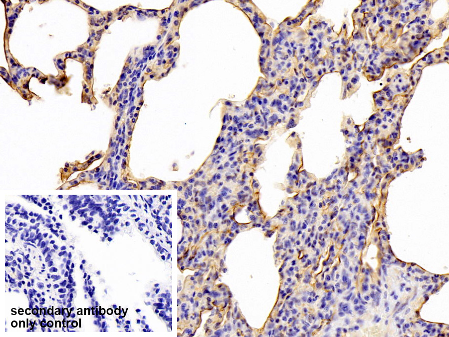 Polyclonal Antibody to Intercellular Adhesion Molecule 1 (ICAM1)