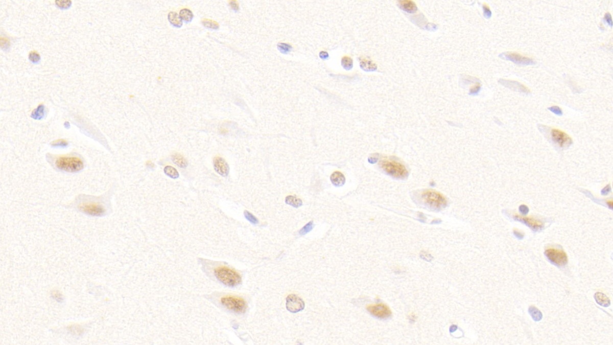 Polyclonal Antibody to Fibroblast Growth Factor 2, Basic (FGF2)