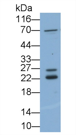 Polyclonal Antibody to Fibroblast Growth Factor 2, Basic (FGF2)