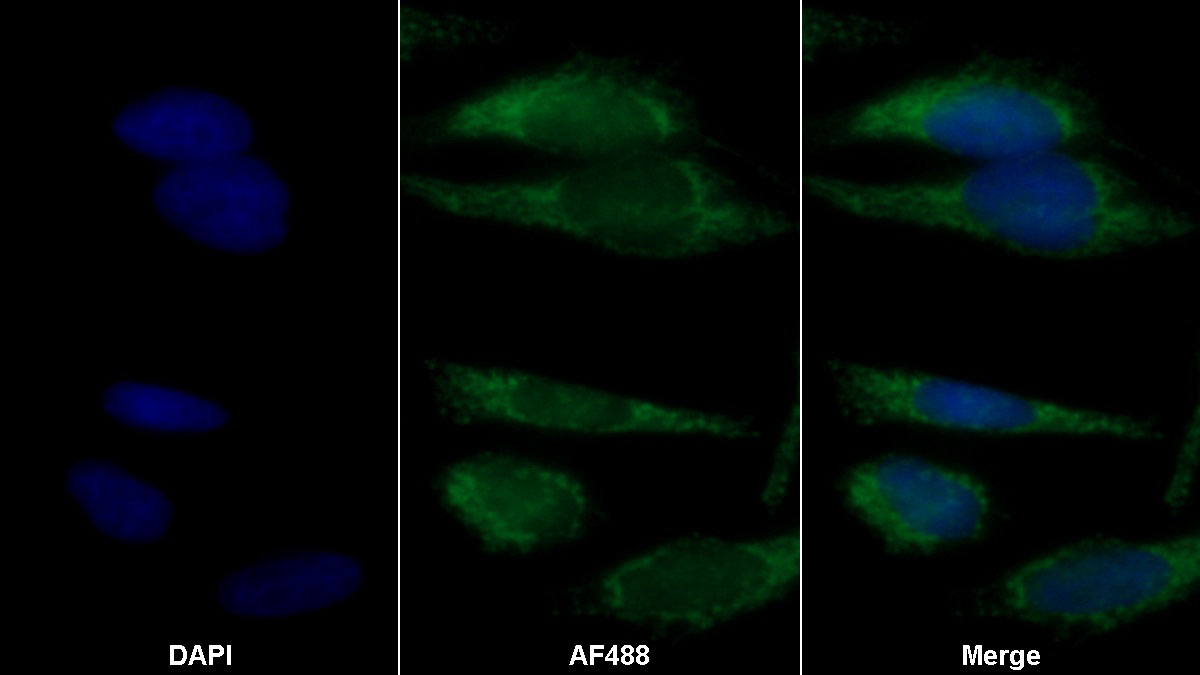 Polyclonal Antibody to Tissue Inhibitors Of Metalloproteinase 1 (TIMP1)