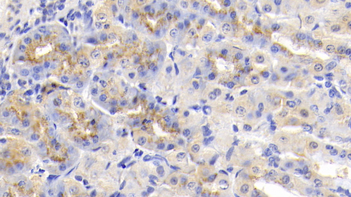 Polyclonal Antibody to Tissue Inhibitors Of Metalloproteinase 1 (TIMP1)