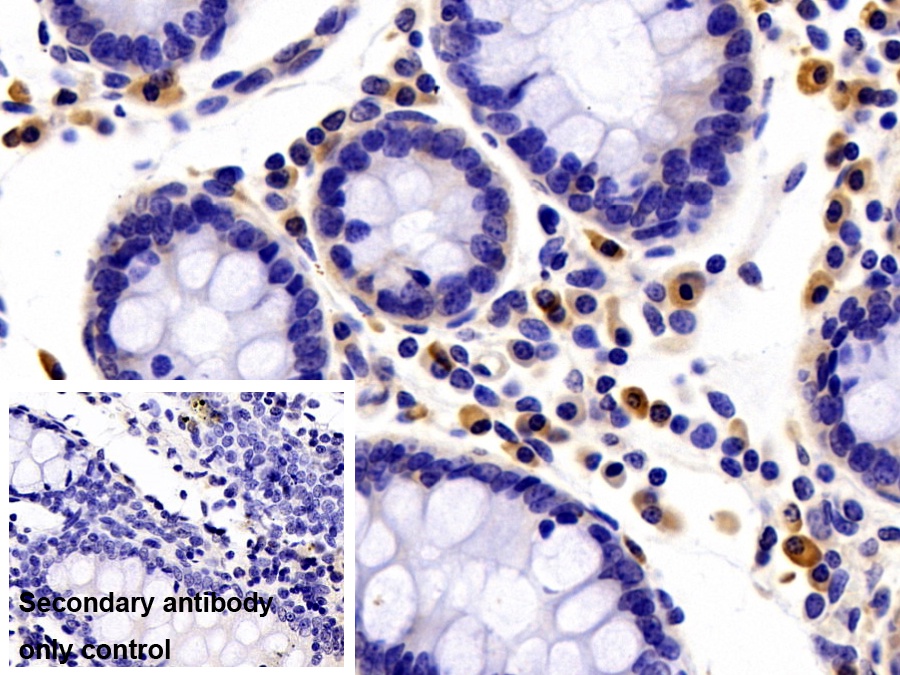 Polyclonal Antibody to Matrix Metalloproteinase 9 (MMP9)