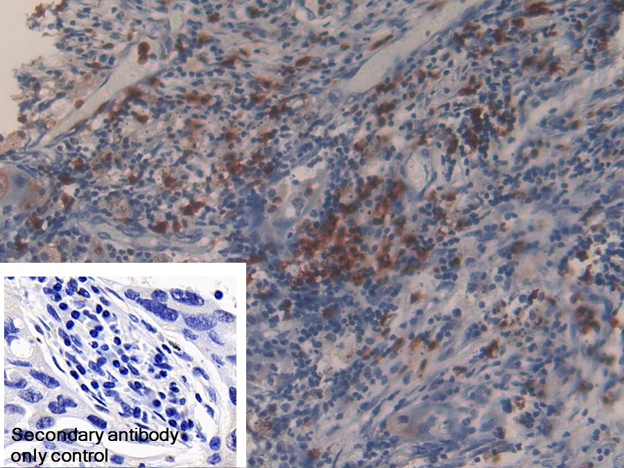 Polyclonal Antibody to Matrix Metalloproteinase 9 (MMP9)