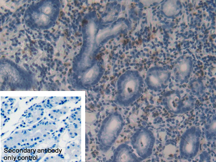 Polyclonal Antibody to Matrix Metalloproteinase 9 (MMP9)