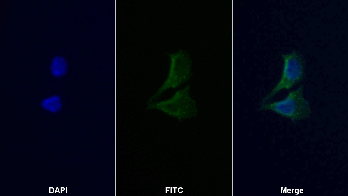 Polyclonal Antibody to Matrix Metalloproteinase 9 (MMP9)