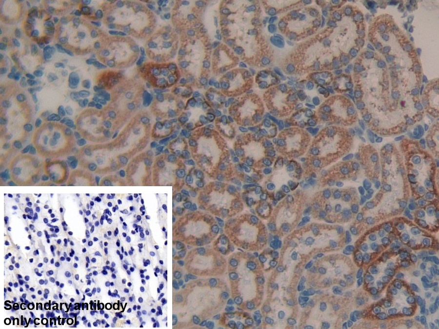 Polyclonal Antibody to Matrix Metalloproteinase 9 (MMP9)