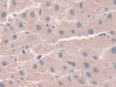 Polyclonal Antibody to Nicotinamide Adenine Dinucleotide Phosphate Oxidase 1 (NOX1)