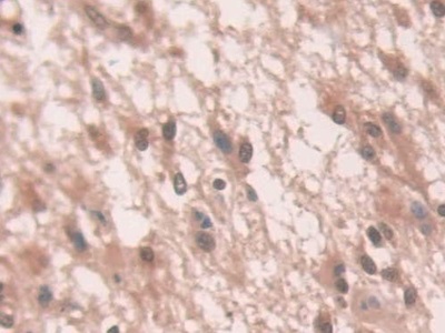 Polyclonal Antibody to Nicotinamide Adenine Dinucleotide Phosphate Oxidase 1 (NOX1)