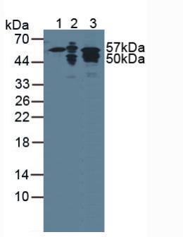 Polyclonal Antibody to Cytokeratin 7 (CK7)