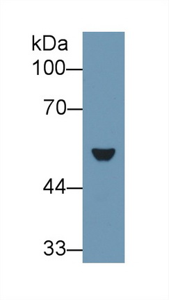 Polyclonal Antibody to Cytokeratin 7 (CK7)