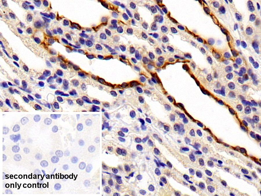 Polyclonal Antibody to Cytokeratin 7 (CK7)