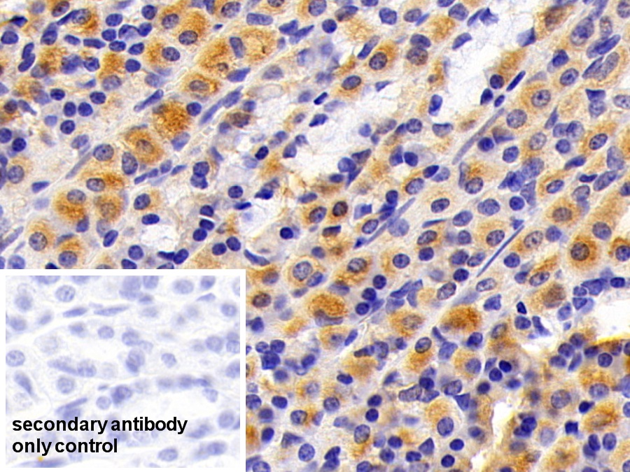 Polyclonal Antibody to Cytokeratin 7 (CK7)