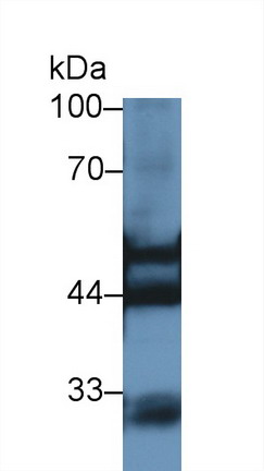 Polyclonal Antibody to Cytokeratin 7 (CK7)