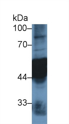 Polyclonal Antibody to Cytokeratin 7 (CK7)