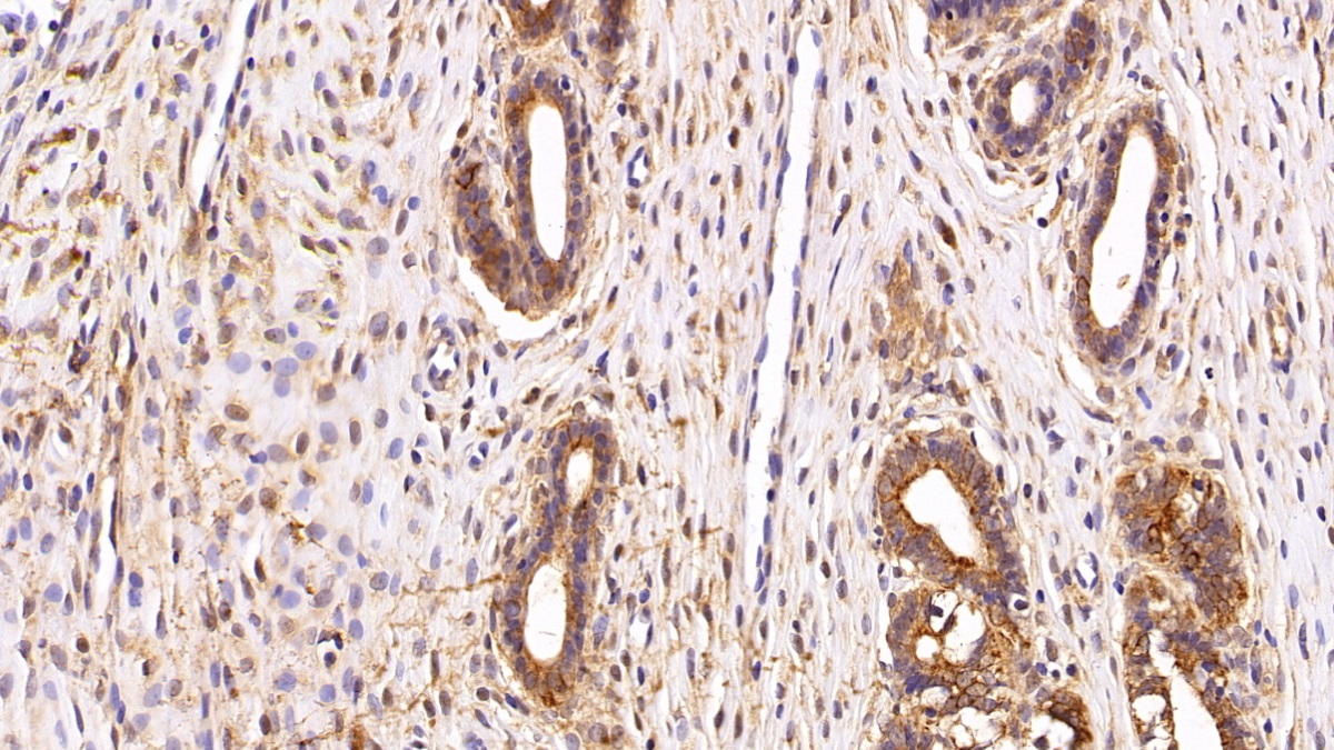 Polyclonal Antibody to Cytokeratin 7 (CK7)