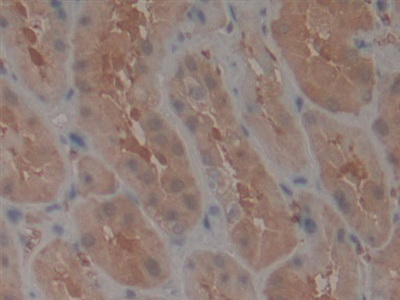 Polyclonal Antibody to Telomerase protein component 1 (TEP1)