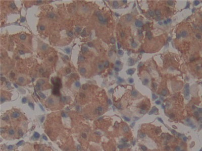 Polyclonal Antibody to Telomerase protein component 1 (TEP1)