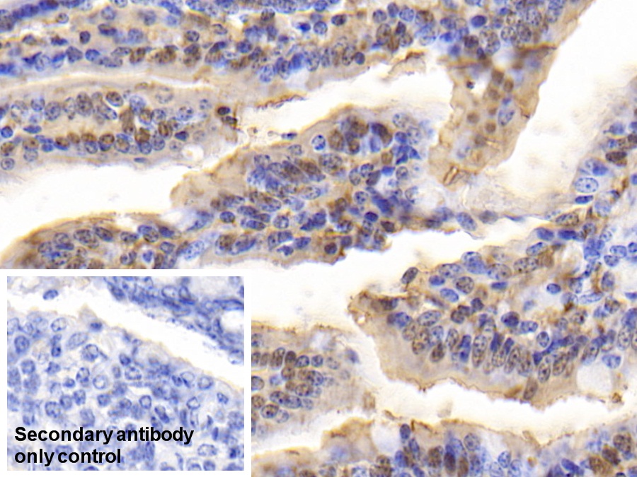 Polyclonal Antibody to Fatty Acid Binding Protein 2, Intestinal (FABP2)