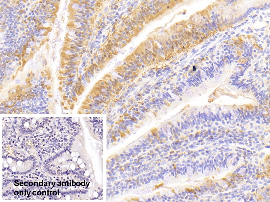 Polyclonal Antibody to Fatty Acid Binding Protein 2, Intestinal (FABP2)