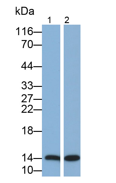 Polyclonal Antibody to Fatty Acid Binding Protein 2, Intestinal (FABP2)