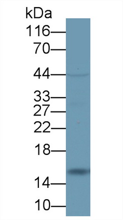 Polyclonal Antibody to Fatty Acid Binding Protein 2, Intestinal (FABP2)