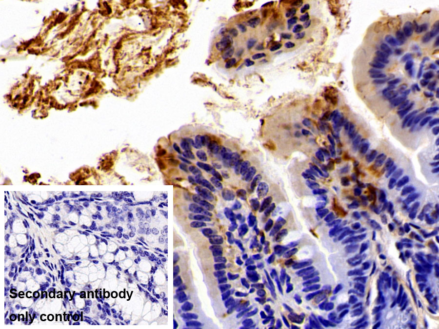 Polyclonal Antibody to Fatty Acid Binding Protein 2, Intestinal (FABP2)