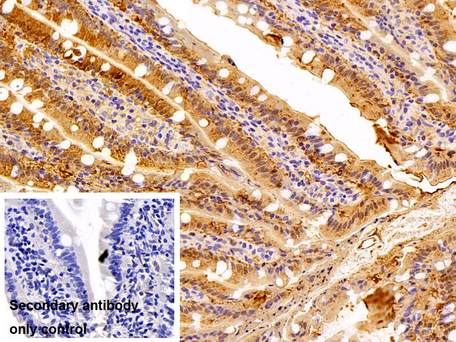 Polyclonal Antibody to Fatty Acid Binding Protein 2, Intestinal (FABP2)