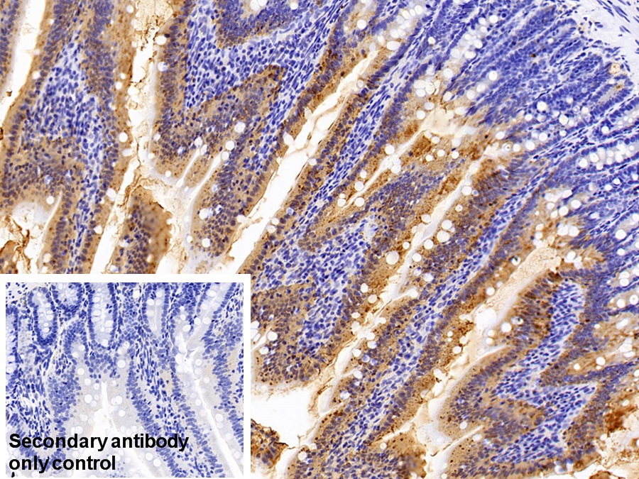 Polyclonal Antibody to Fatty Acid Binding Protein 2, Intestinal (FABP2)