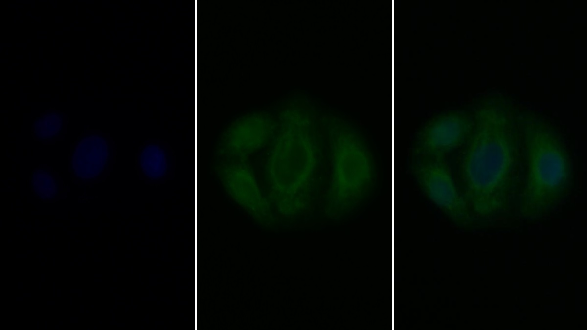 Polyclonal Antibody to Leukemia Inhibitory Factor Receptor (LIFR)