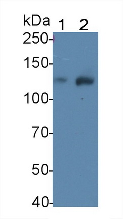 Polyclonal Antibody to Leukemia Inhibitory Factor Receptor (LIFR)