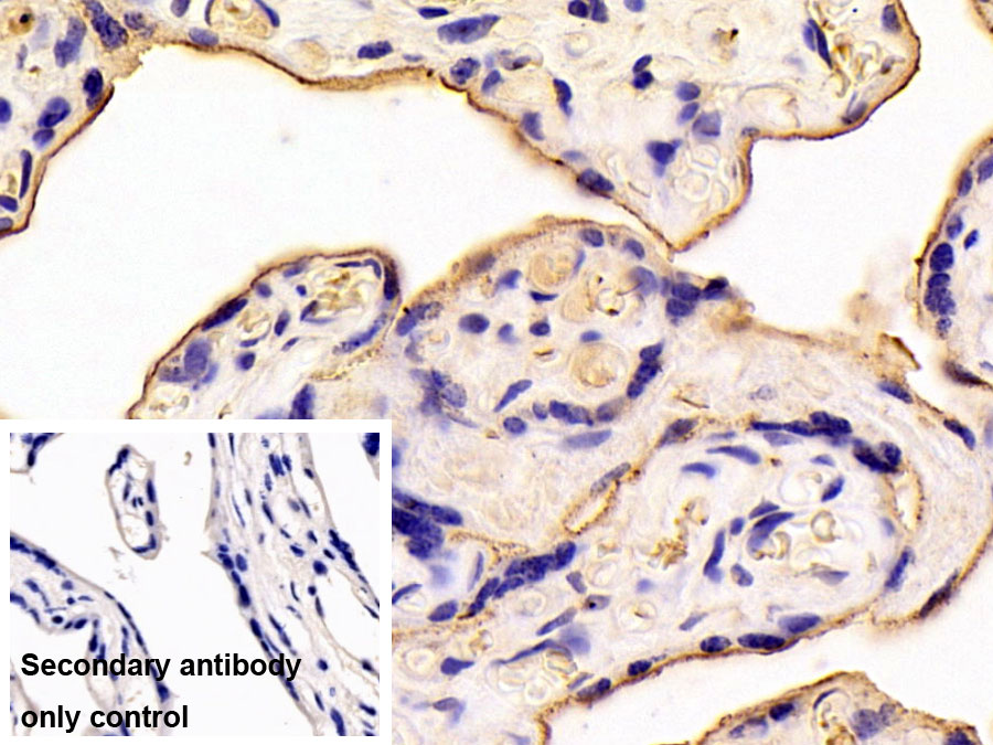 Polyclonal Antibody to Leukemia Inhibitory Factor Receptor (LIFR)