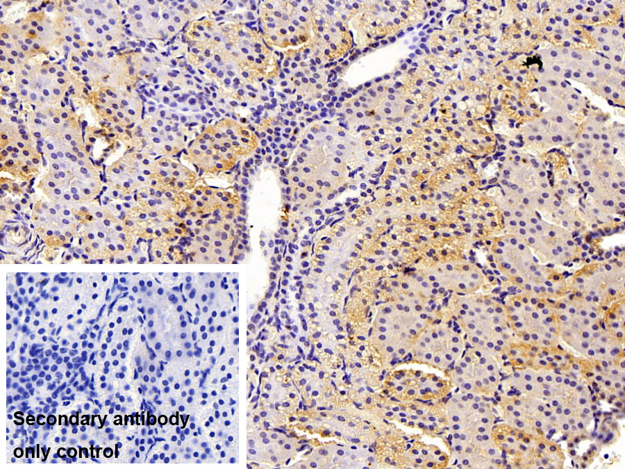 Polyclonal Antibody to Leukemia Inhibitory Factor Receptor (LIFR)