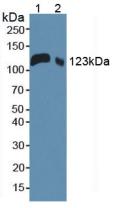 Polyclonal Antibody to Leukemia Inhibitory Factor Receptor (LIFR)