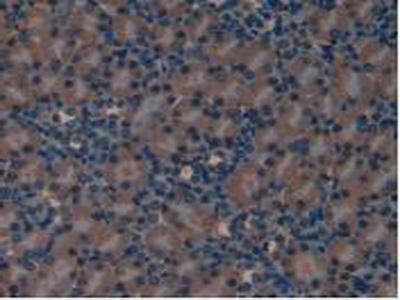 Polyclonal Antibody to Leukemia Inhibitory Factor Receptor (LIFR)