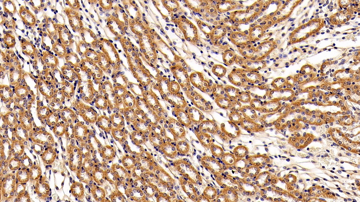 Polyclonal Antibody to Leukemia Inhibitory Factor Receptor (LIFR)