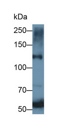 Polyclonal Antibody to Leukemia Inhibitory Factor Receptor (LIFR)