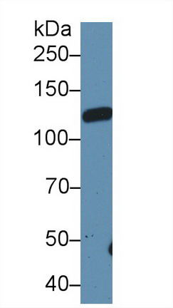 Polyclonal Antibody to Leukemia Inhibitory Factor Receptor (LIFR)