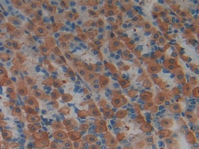 Polyclonal Antibody to Leukemia Inhibitory Factor Receptor (LIFR)