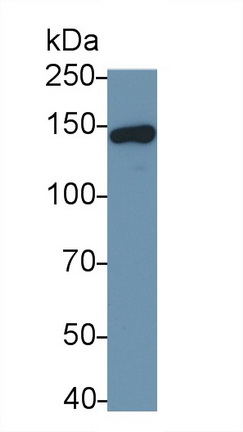 Polyclonal Antibody to Leukemia Inhibitory Factor Receptor (LIFR)