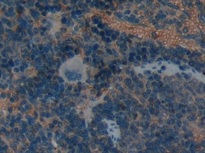 Polyclonal Antibody to Leukemia Inhibitory Factor Receptor (LIFR)