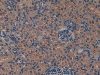 Polyclonal Antibody to Leukemia Inhibitory Factor Receptor (LIFR)