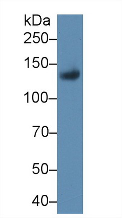 Polyclonal Antibody to Leukemia Inhibitory Factor Receptor (LIFR)