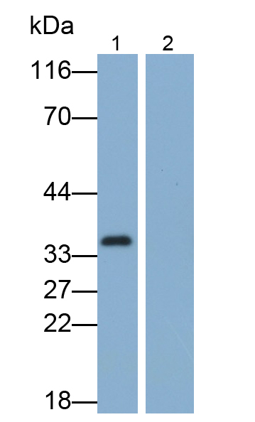 Polyclonal Antibody to Interleukin 1 Beta (IL1b)