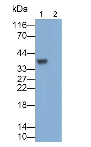 Polyclonal Antibody to Interleukin 1 Beta (IL1b)