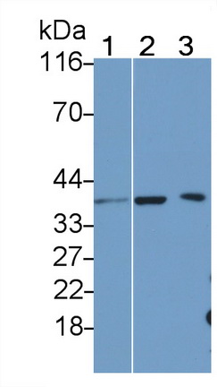 Polyclonal Antibody to Interleukin 1 Beta (IL1b)