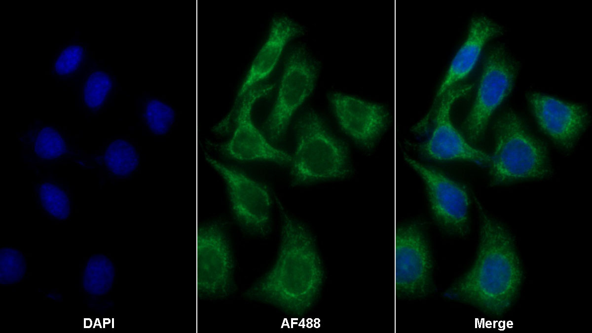 Polyclonal Antibody to Heparan Sulfate Proteoglycan (HSPG)